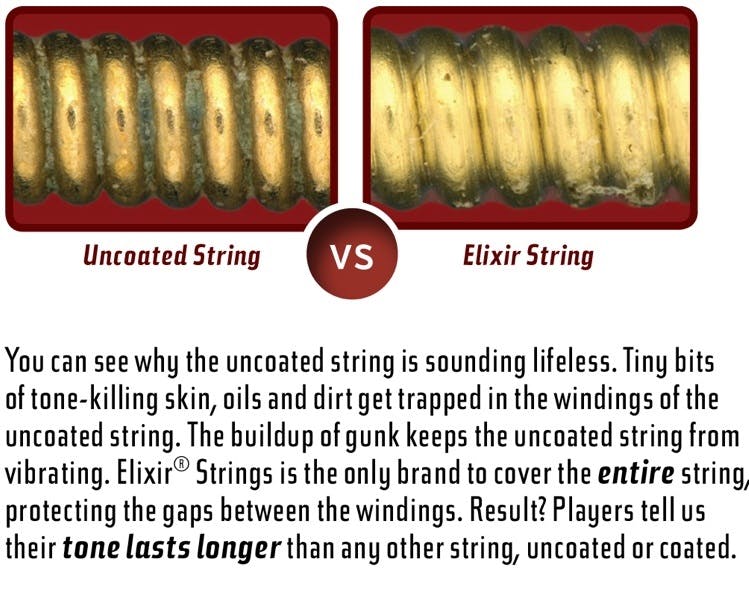Elixir String Gauge Chart
